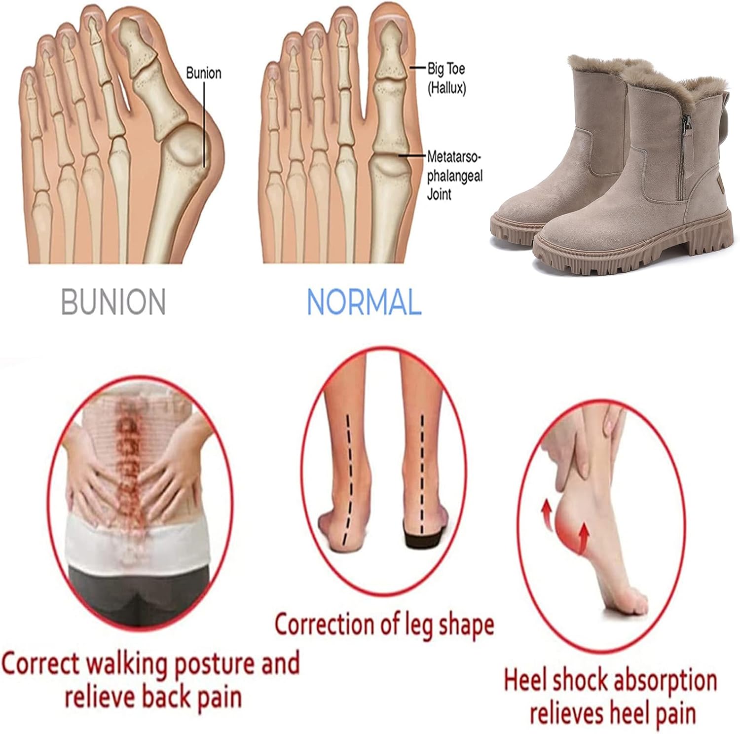 Lorraine | Orthopaedic boots